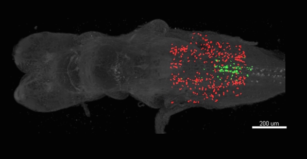 Les perturbateurs endocriniens auraient un impact sur le cerveau