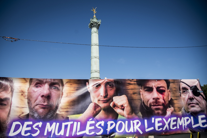 Marche des mutilés : «<small class="fine d-inline"> </small>Le <span class="caps">LBD40</span> est devenu une arme de terreur politique<small class="fine d-inline"> </small>»