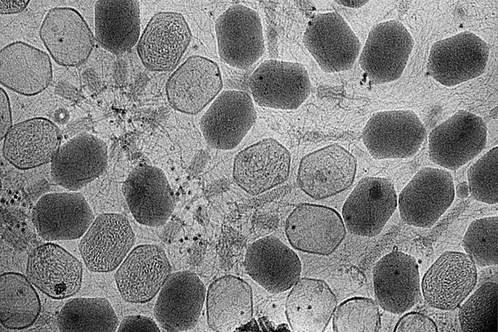 Comment vaincre la résistance aux antibiotiques<small class="fine d-inline"> </small>? Par la «<small class="fine d-inline"> </small>phagothérapie<small class="fine d-inline"> </small>»