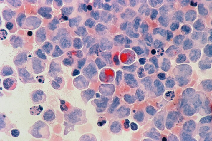Perturbateurs endocriniens : «<small class="fine d-inline"> </small>La prévention pourrait stopper la progression alarmante des maladies<small class="fine d-inline"> </small>»